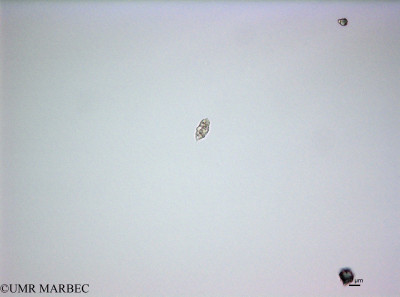 phyto/French_Polynesia/Tahiti_Ifremer/PHYTOCONT June 2015/Cochlodinium miniatum (ancien Cf_Katodinium150731_001_ovl-3).tif(copy)_thumb.jpg